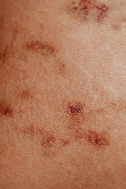 Choosing the Right Moisturizers: Tips for Nourishing Affected Areas