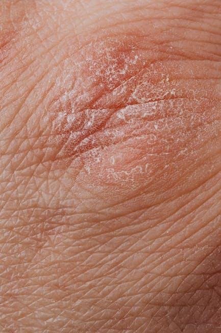 Understanding Psoriasis: The Importance of Gentle Skincare Solutions