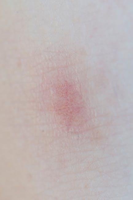 Understanding the Causes of Skin Redness